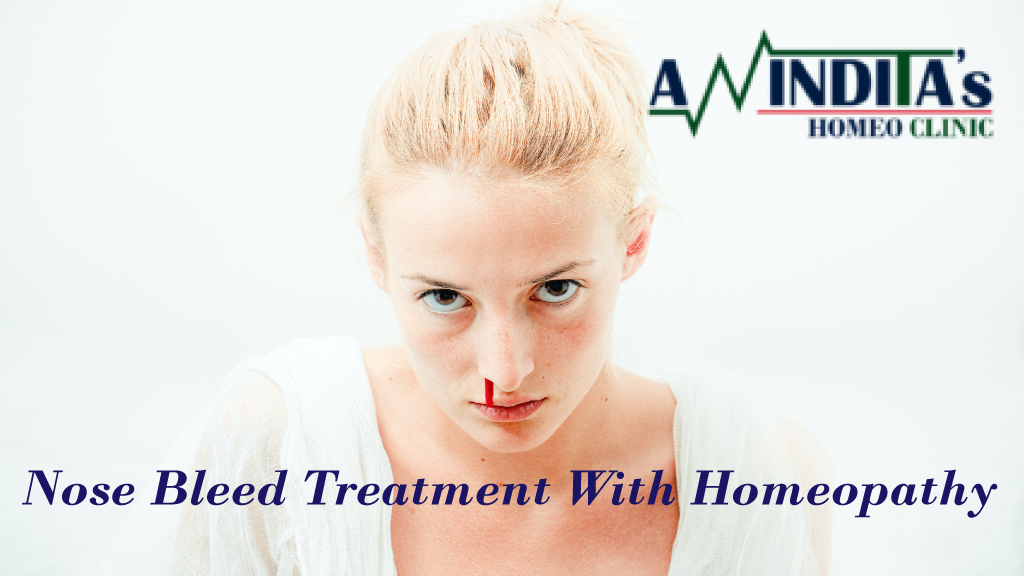 Nose Bleed Treatment With Homeopathy in Kolkata – Dr. Anindita Mukherjee (One of the best homeopathy doctor in Kolkata) – Copy